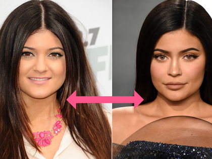 Beauty-Lexikon: Die besten Tricks bei schmalen Lippen