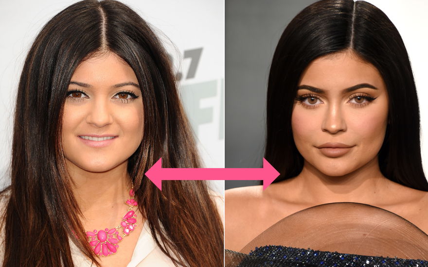 Beauty-Lexikon: Die besten Tricks bei schmalen Lippen