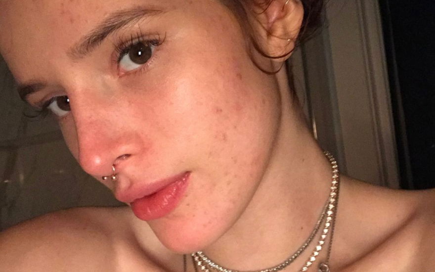 Beauty-Lexikon: Die besten Mittel gegen Akne