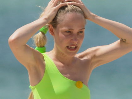 GNTM-Theresia Fischer: Komplikationen nach Bein-OP! "So eine Drecksschei*e"