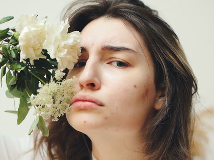 Retinol-Erstverschlimmerung: Was es mit Skin Purging auf sich hat
