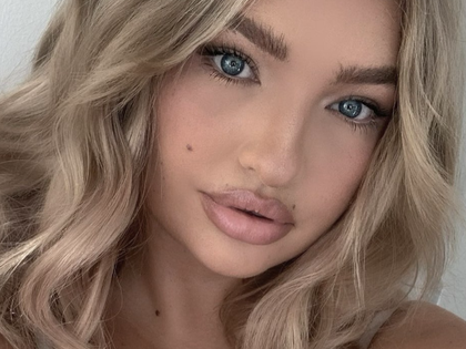 GNTM-Star Sarina Nowak: Schock-Diagnose - Sie hatte einen Hirntumor
