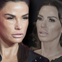 Katie Price: Endet ihr Beauty-Wahn tragisch?