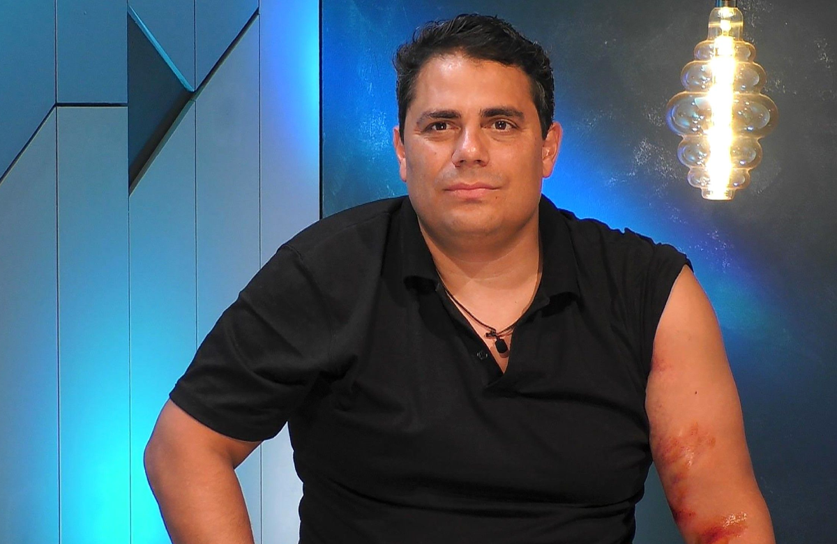 Silva Gonzalez mit einer Armverletzung bei "Prominent getrennt"