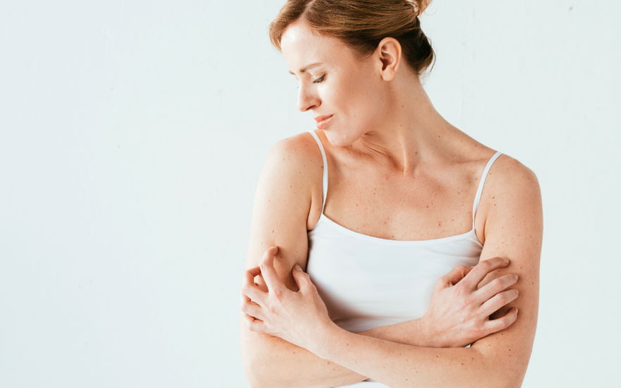 Reibeisenhaut behandeln: Die 3 besten Cremes gegen Keratosis pilaris