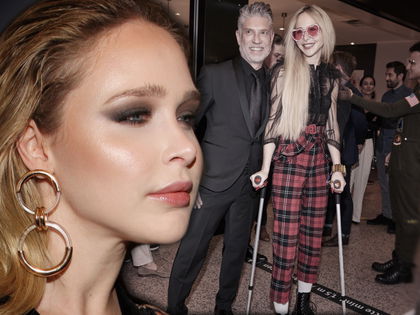 GNTM-Theresia Fischer: Dramatischer OP-Wahn für ihren Ex-Partner