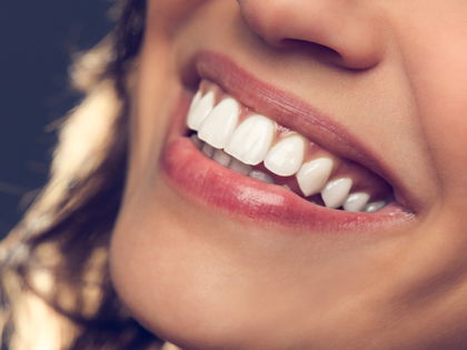 Weiße Zähne: Diese Paste wirkt wie eine professionelle Zahnreinigung