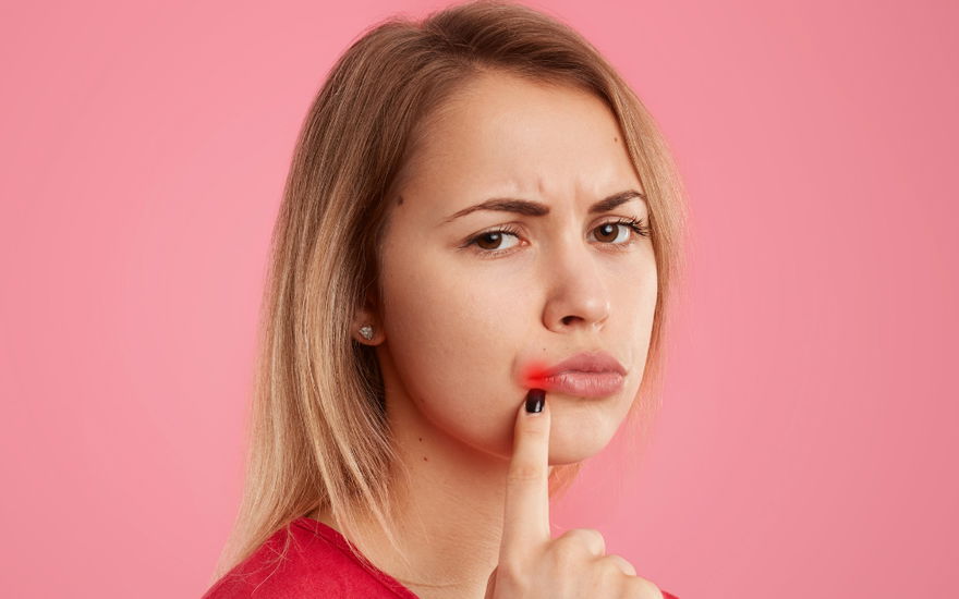 Herpes vorbeugen: So entstehen Lippenbläschen gar nicht erst