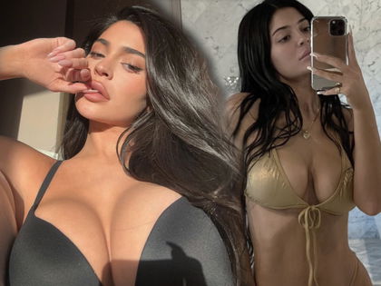 Kylie Jenner: Beauty-OP-Beichte! "Würde alles anders machen"