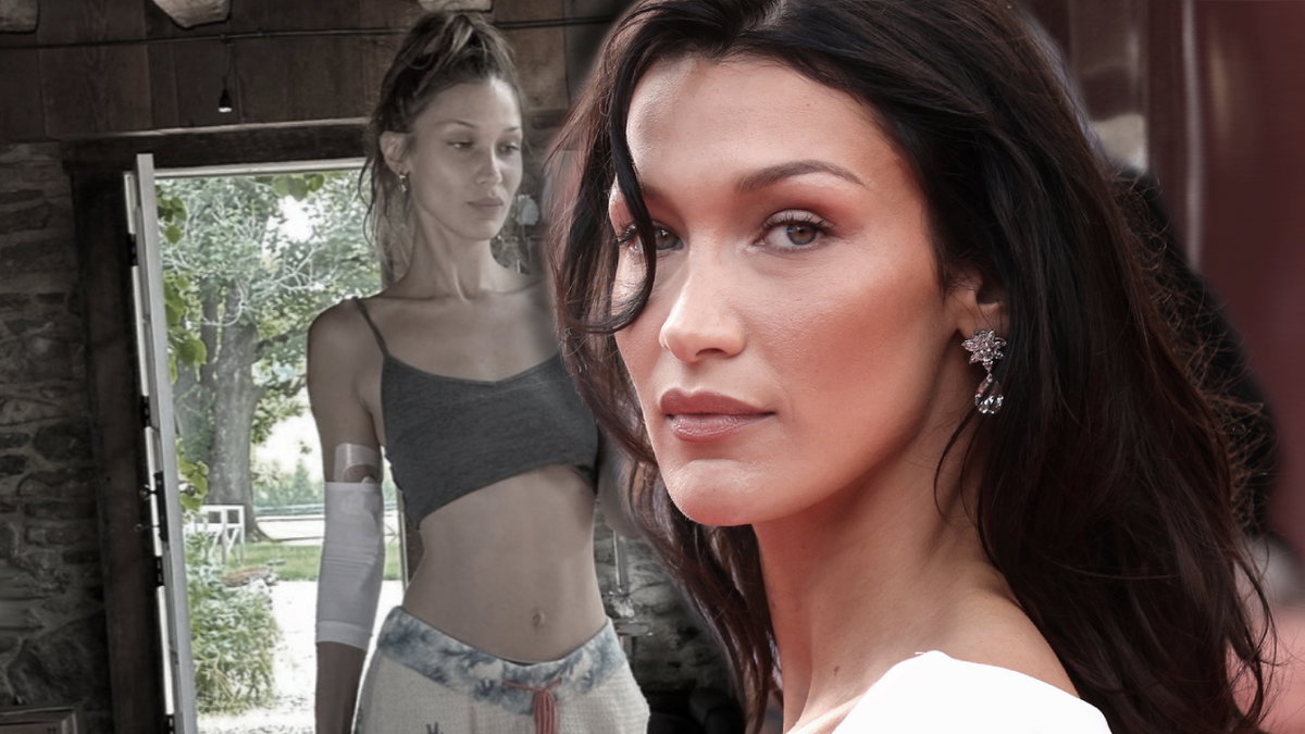 Bella Hadid zeigt sich mit verwundetem Arm