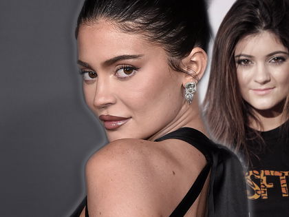 Kylie Jenner: Trauriges Fazit um Beauty-OPs