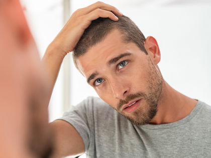 Streuhaar: In Sekunden zur Haarverdichtung und vollem Haar