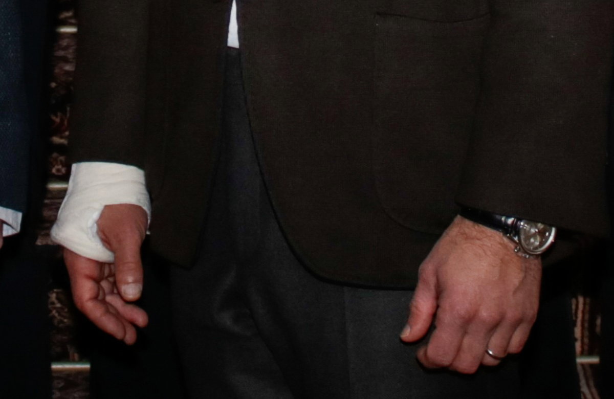 Prinz Carl Philips verletzte Hand in einem Gips.