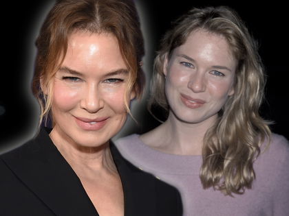 Renée Zellweger: Früher & heute - Ihre krasse Veränderung