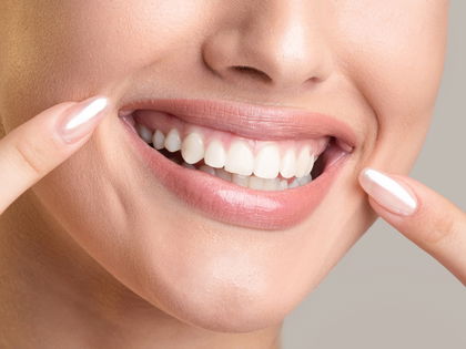 Marionettenfalten loswerden: Mit diesen 3 Tipps brauchst du keine OP