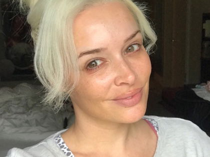 Daniela Katzenberger: Im Beauty-Wahn?