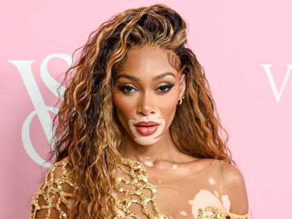 Winnie Harlow: Was für eine Krankheit hat das Topmodel?