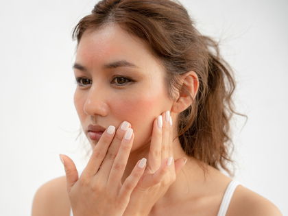 Gegen Rötungen: Dieses Sensitiv-Serum wirkt wahre Wunder