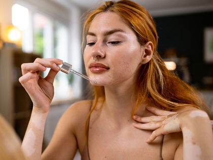 Beauty-Trend 2024: Dieses Niacinamid-Serum ist ein Topseller