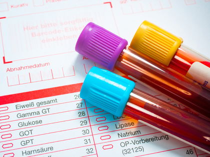 Blutbild: Das verrät es über unsere Gesundheit