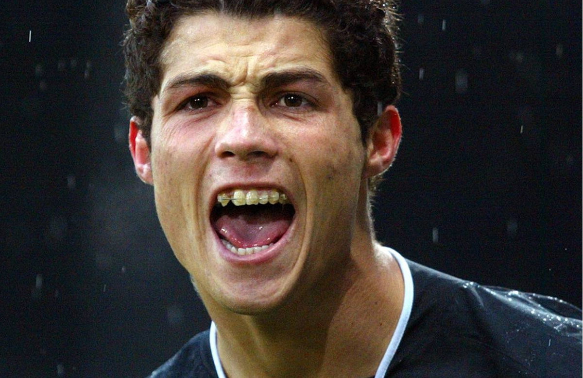 Cristiano Ronaldo mit Zahnspange, 2005