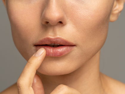 Hausmittel gegen trockene Lippen: Das sind die 5 besten Naturmittel