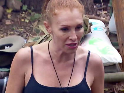 Georgina Fleur: Mit blauem Auge im Dschungelcamp? Das steckt dahinter - "Schreckliches passiert"