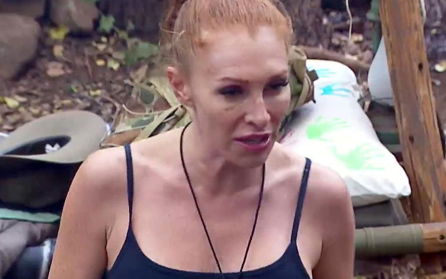Georgina Fleur mit blauem Auge im Dschungelcamp