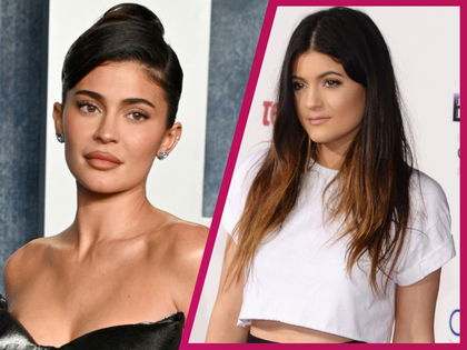 Kylie Jenner: Jetzt packt sie über ihre Beauty-OPs aus - "Habe nicht viel machen lassen"