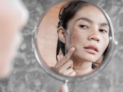 Anti-Aging: Mit diesem Korrekturstift korrigierst du Pigmentflecken sichtbar