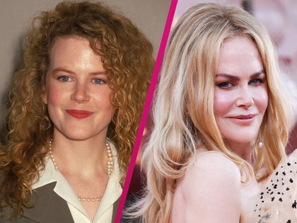 Nicole Kidman, Demi Moore & Co.: Botox & Beauty-OPs - Warum tut ihr euch das an?