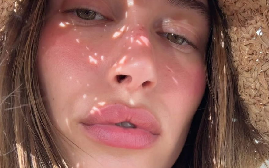 Hailey Bieber rötliche Haut und Schmollmund