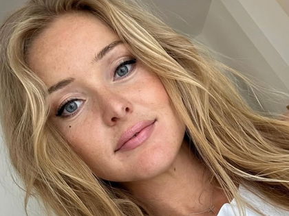 Patrice Aminati: Trotz Haarverlust – "Ich will mich schön und sexy fühlen"