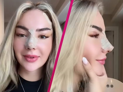 Emma Fernlund: User spotten heftig nach Beauty-OP – "Sieht aus wie Kim Virginias Schwester"
