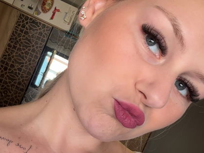 Sarah-Jane Wollny: Beauty-Fail! "Sieht Katastrophe aus"