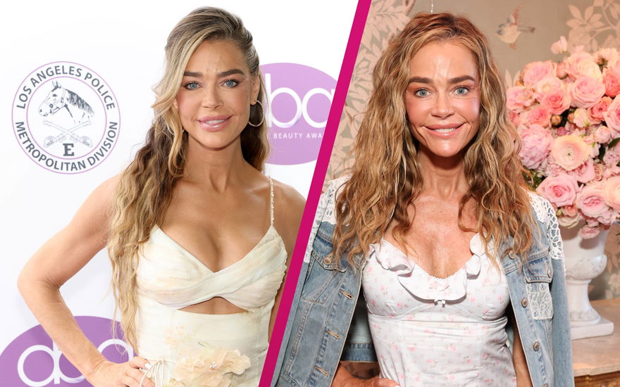 Denise Richards vor und nach den Beauty-OPS