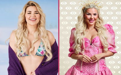 Kim Virginia Hartung damals & heute: So sah sie früher vor ihren Beauty-Eingriffen aus