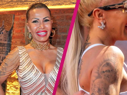 "Schlussstrich": Ginger Costello-Wollersheim lässt Bert-Tattoo entfernen