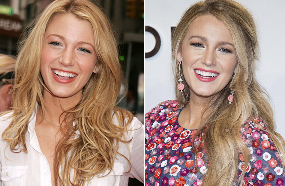 Blake Lively früher und heute