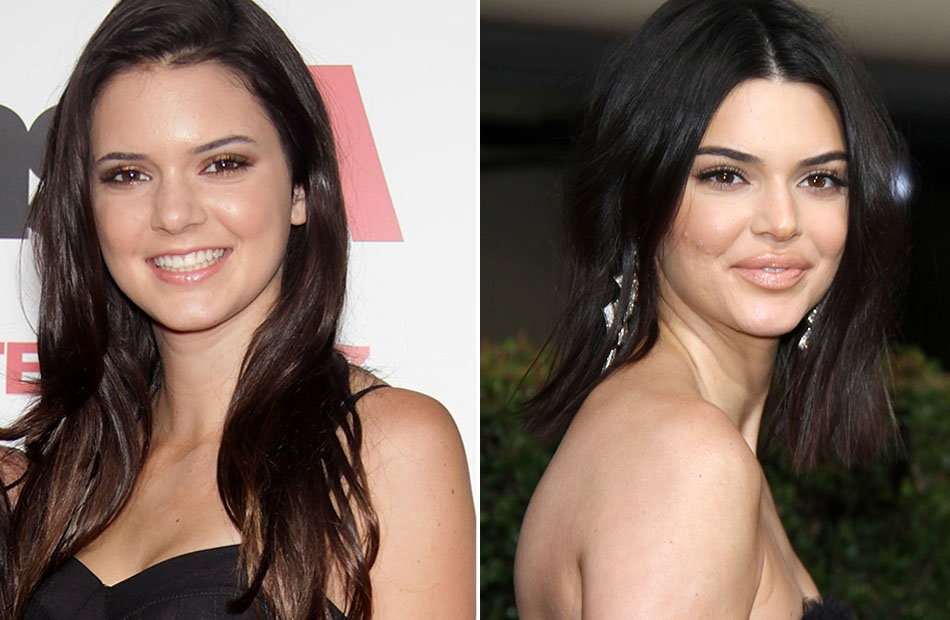 Kendall Jenner früher und heute