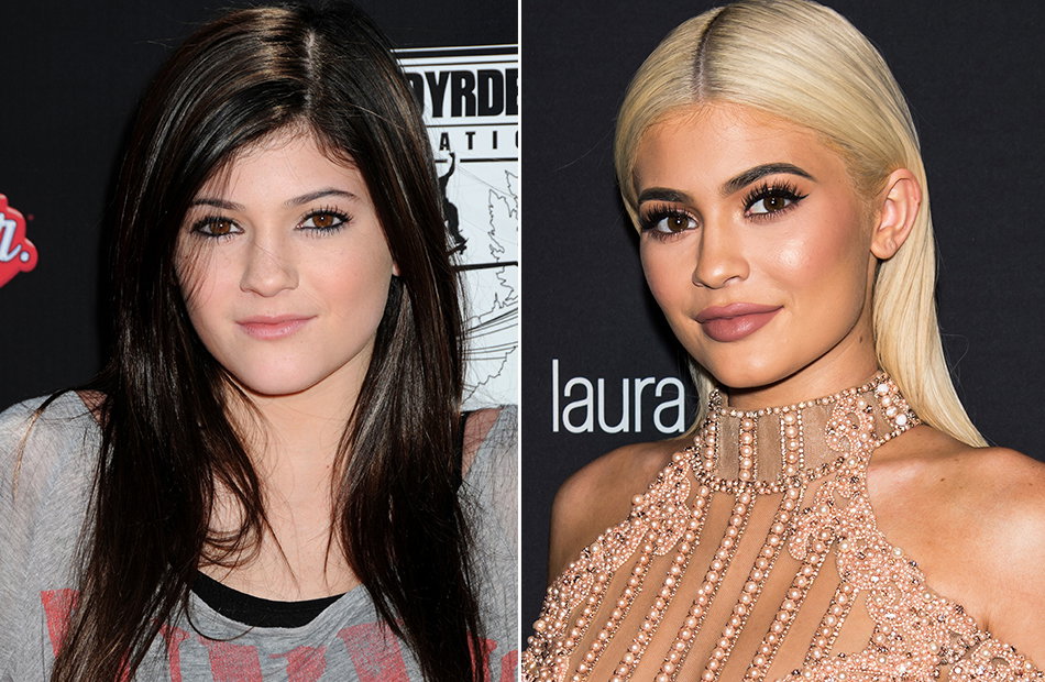 Kylie Jenner früher und heute
