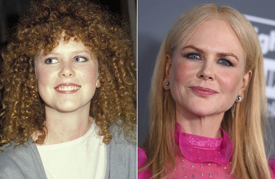 Nicole Kidman früher und heute