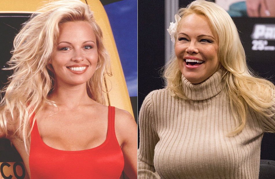 Pamela Anderson früher und heute