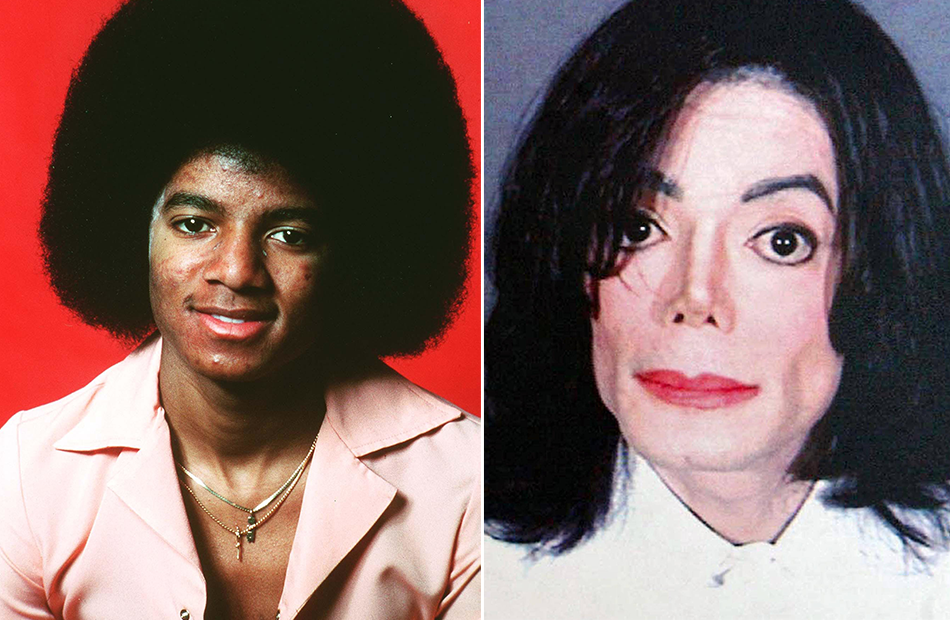 Michael Jackson früher und später