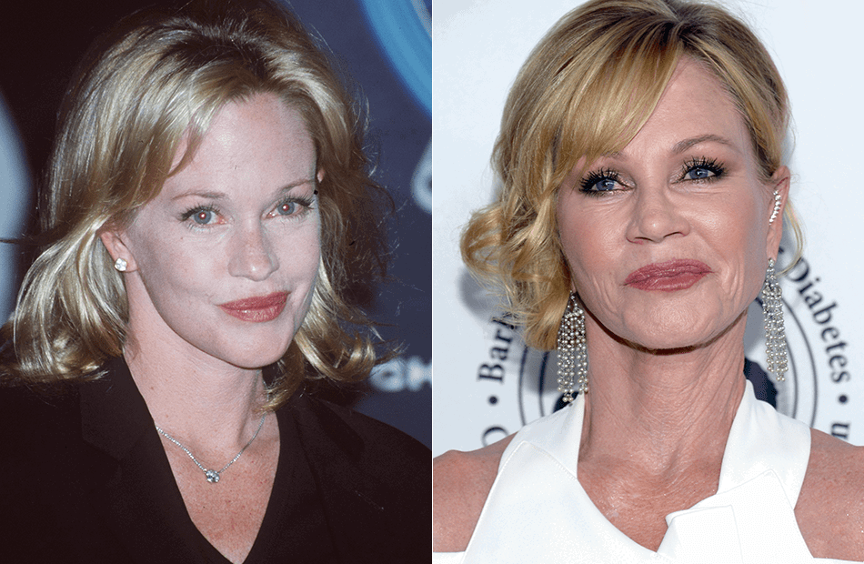 Melanie Griffith früher und heute