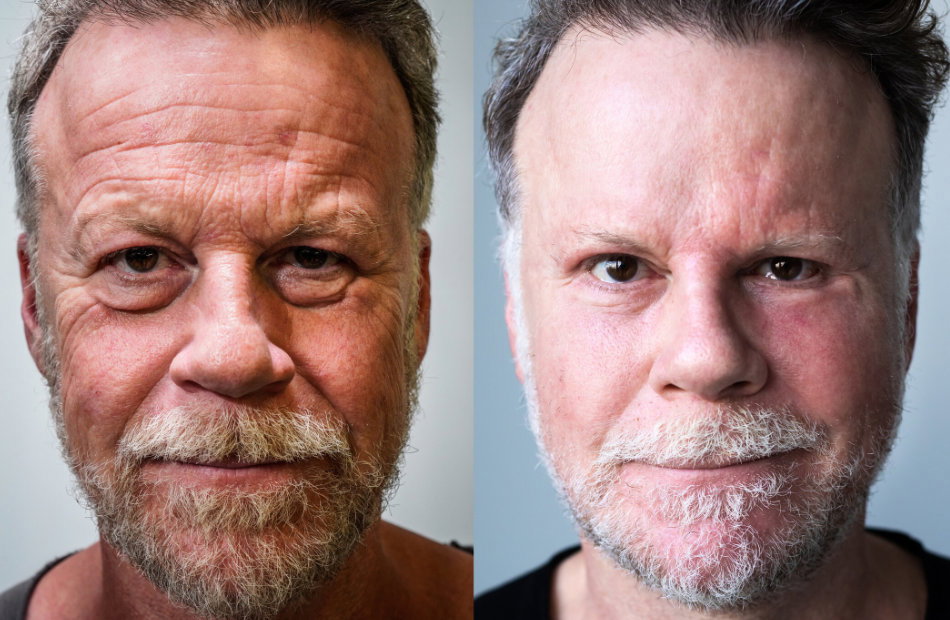 Jenke von Wilmsdorff vor und nach seinem Schönheits-Experiment