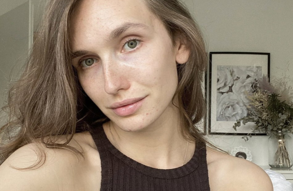 Anna Wilken sieht blass aus