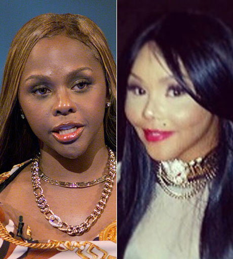 Lil' Kim's Gesicht ist wegen unzähliger Schönheits-OP's nicht mehr wiederzuerkennen