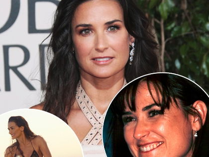 Die geheime OP-Liste - Stars unterm Messer
