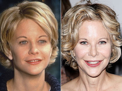 Botox-Panne: Meg Ryan ist kaum wiederzuerkennen! - Die Schauspielerin hat der Beauty-Wahn gepackt